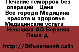 Лечение геморроя без операций › Цена ­ 300 - Все города Медицина, красота и здоровье » Медицинские услуги   . Ненецкий АО,Верхняя Пеша д.